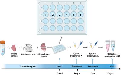 Cytotoxic response of tumor-infiltrating lymphocytes of head and neck cancer slice cultures under mitochondrial dysfunction